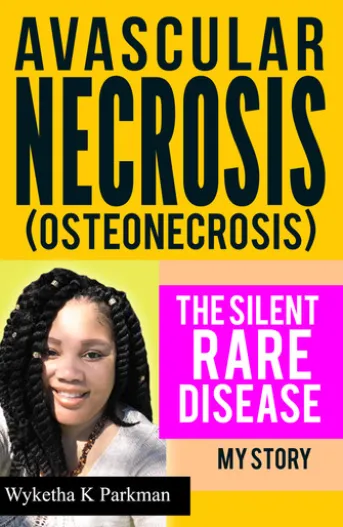Avascular Necrosis (Osteonecrosis): The Silent Rare Disease: My Story
